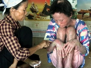 越南橙毒剂受害者